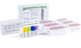 A Blood Test for Alzheimer’s: What to Know