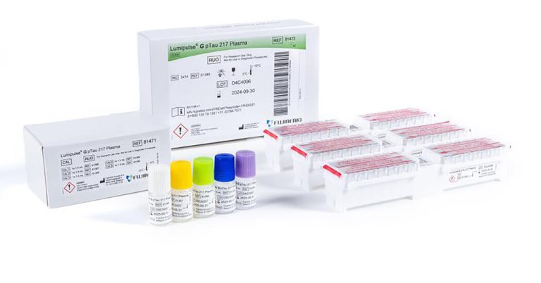 Read more about the article A Blood Test for Alzheimer’s: What to Know
