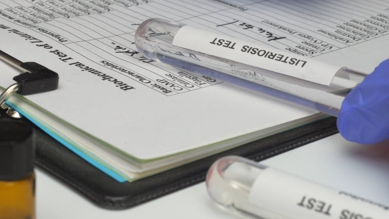what’s-behind-the-recent-spike-in-listeria-recalls?