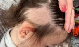 Mum’s warning after Temu brush rips out child’s hair