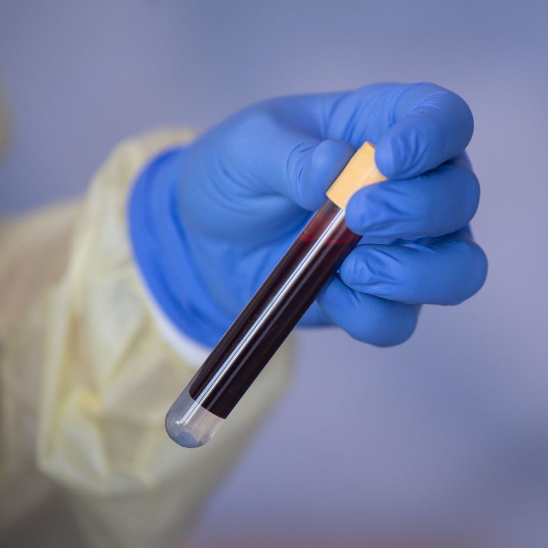 Read more about the article n